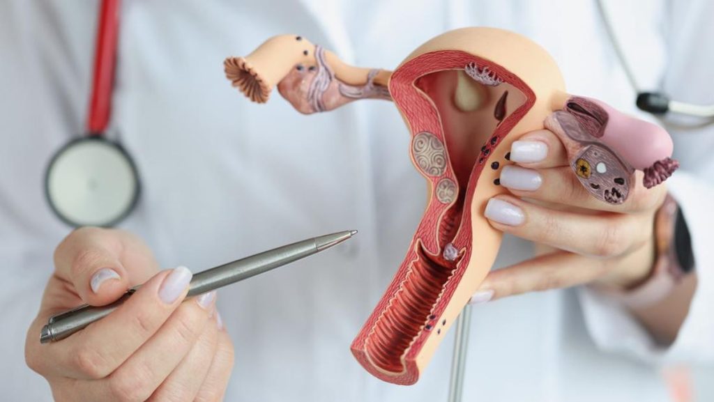 Pap Smear Jadi Langkah Penting Deteksi Dini Kanker Serviks